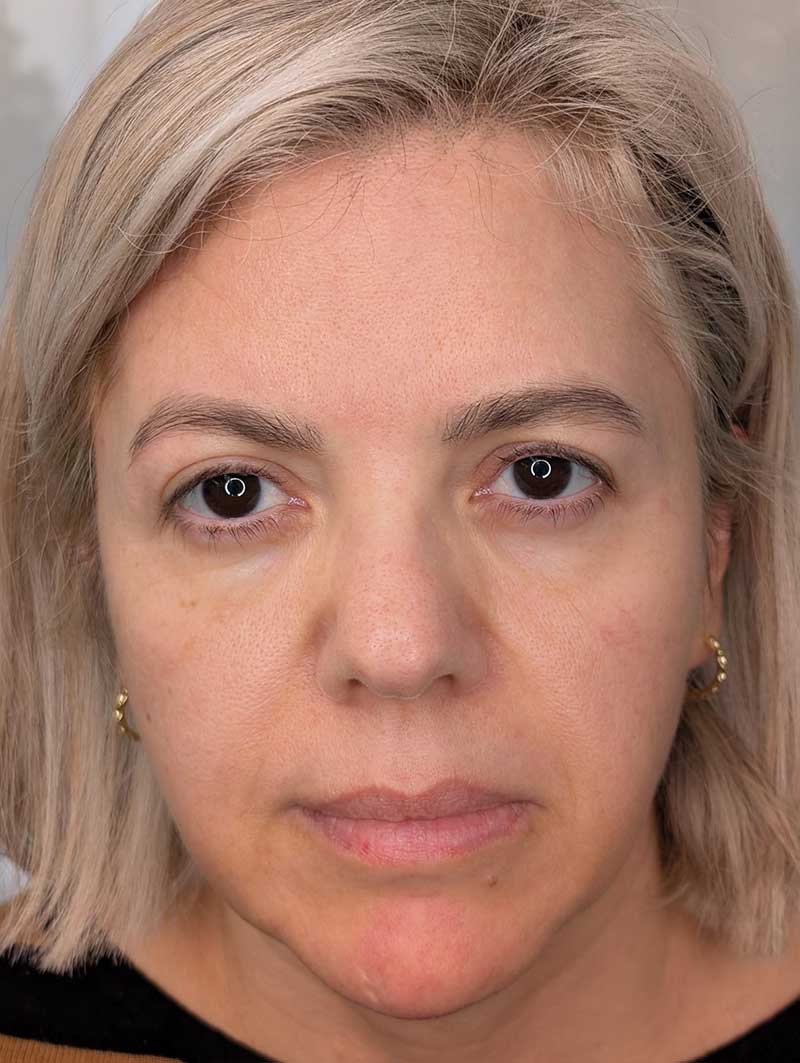Nano-Brows-after-1