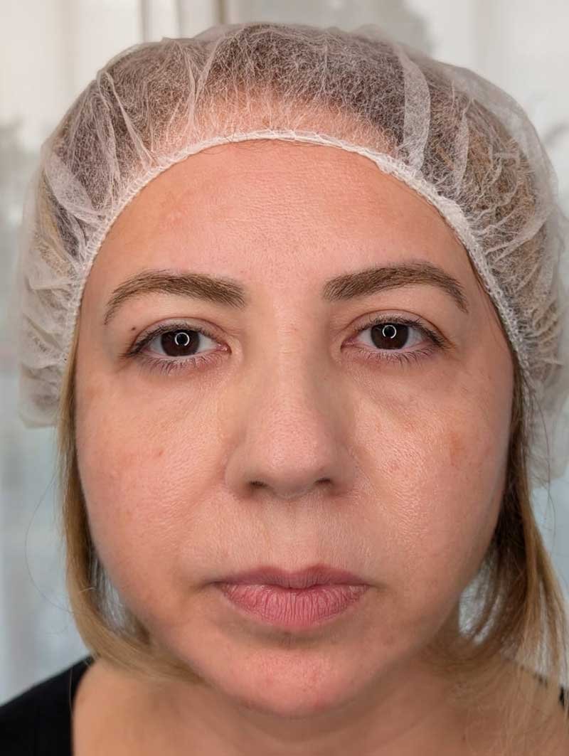 Permanent-Powder-Brows-after-22
